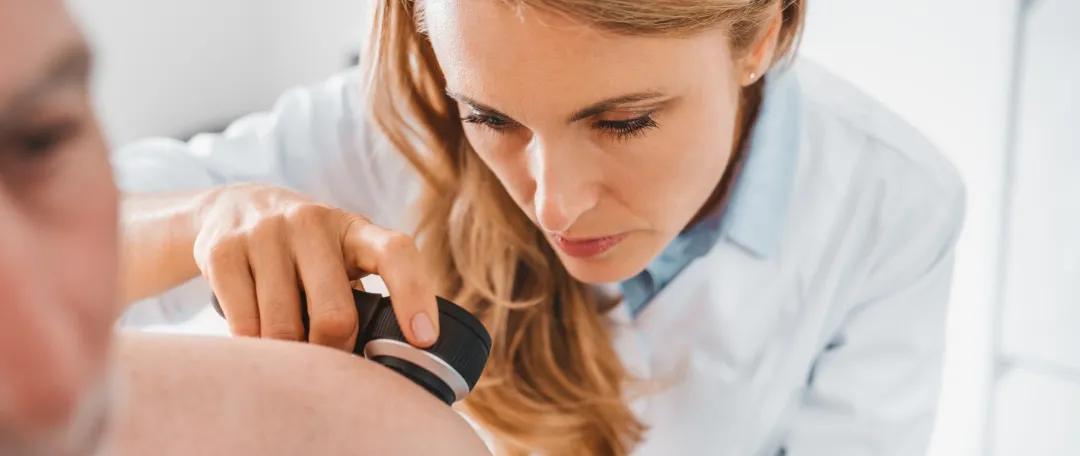 Skin check appointment with a GP at The Doctors